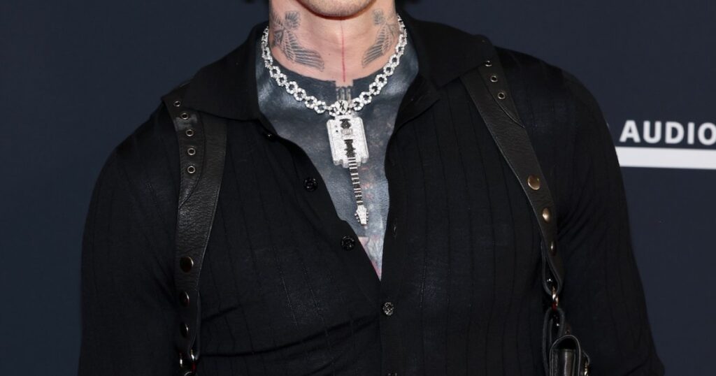 Machine Gun Kelly Shares Photo of Bloody Hand With Chunky Ring, Zooms In on Fresh Pimple