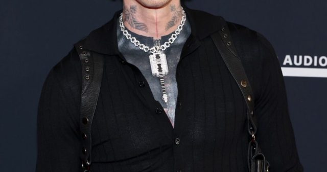 Machine Gun Kelly Shares Photo of Bloody Hand With Chunky Ring, Zooms In on Fresh Pimple