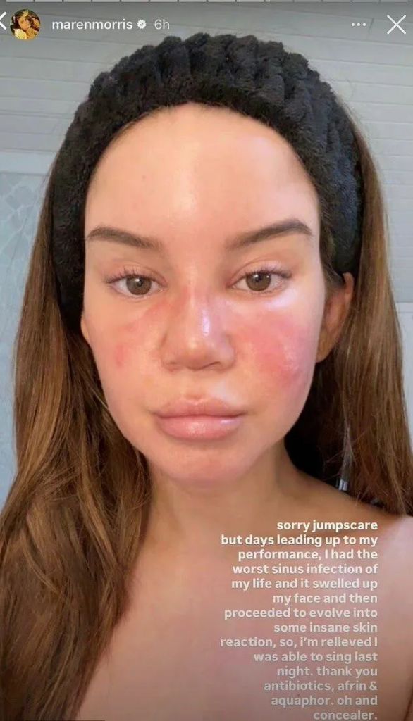 maren morris sinus infection selfie