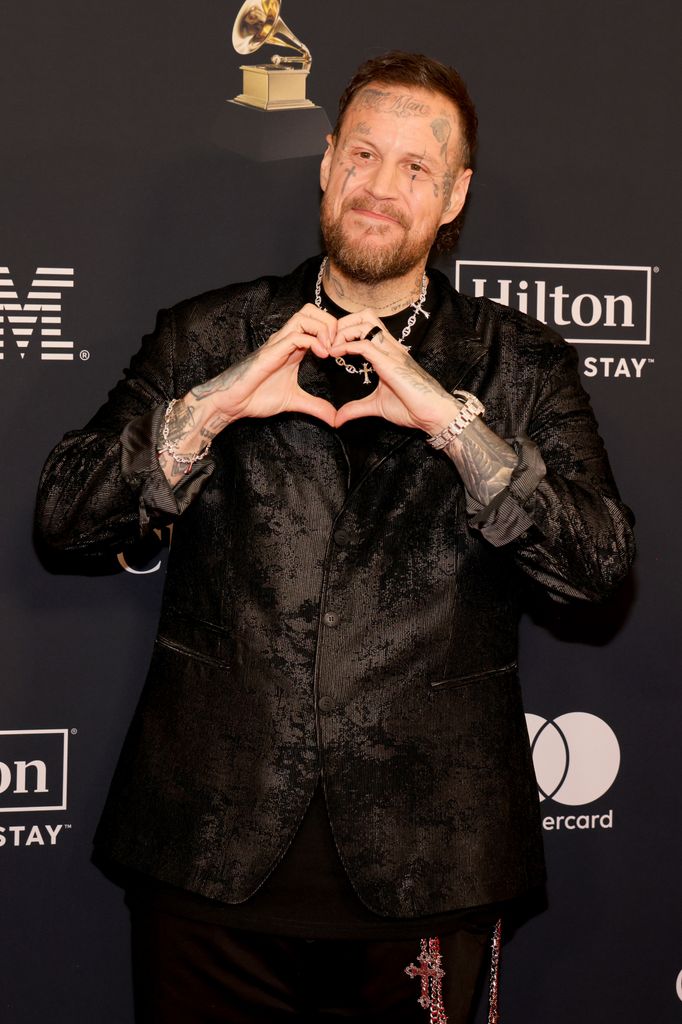 Jelly Roll looks so different!