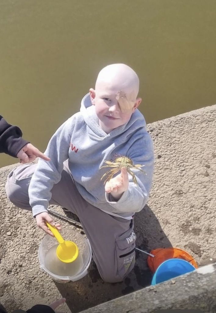 young boy by lake holding crab with bandage on eye