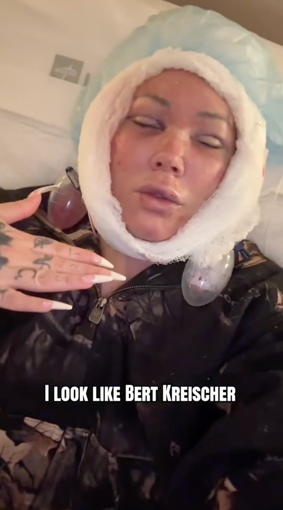 bunnie xo plastic surgery