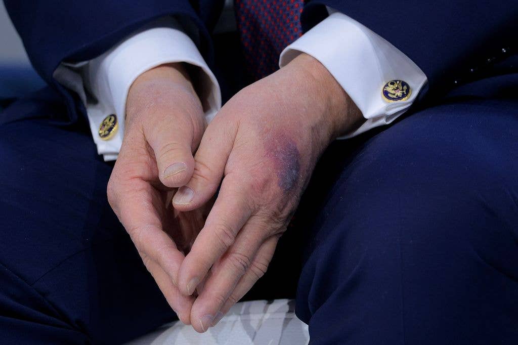Donald Trump is going for his 3rd check up in 13 months