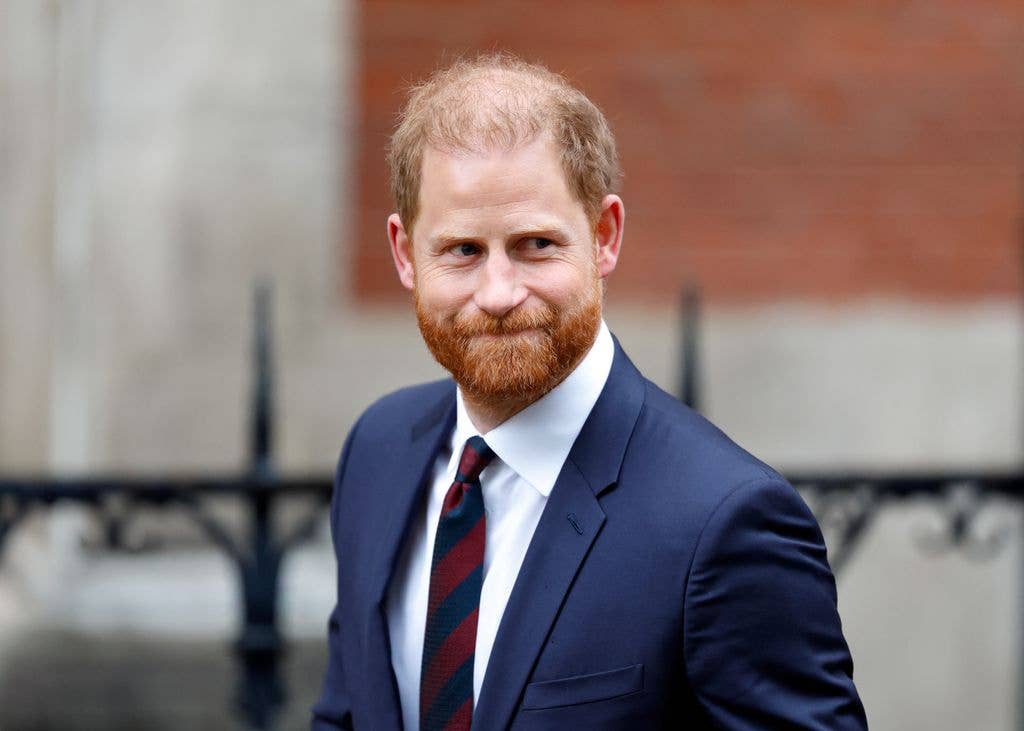 prince harry thinning hair