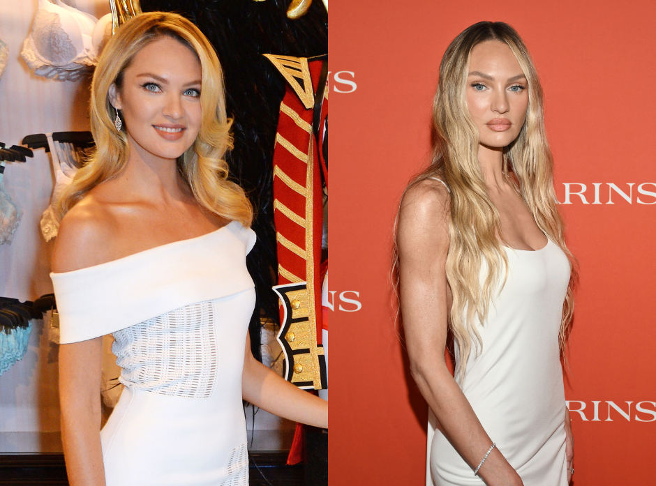 Split image of Candice Swanepoel. On the left in 2014,on the right in 2026.