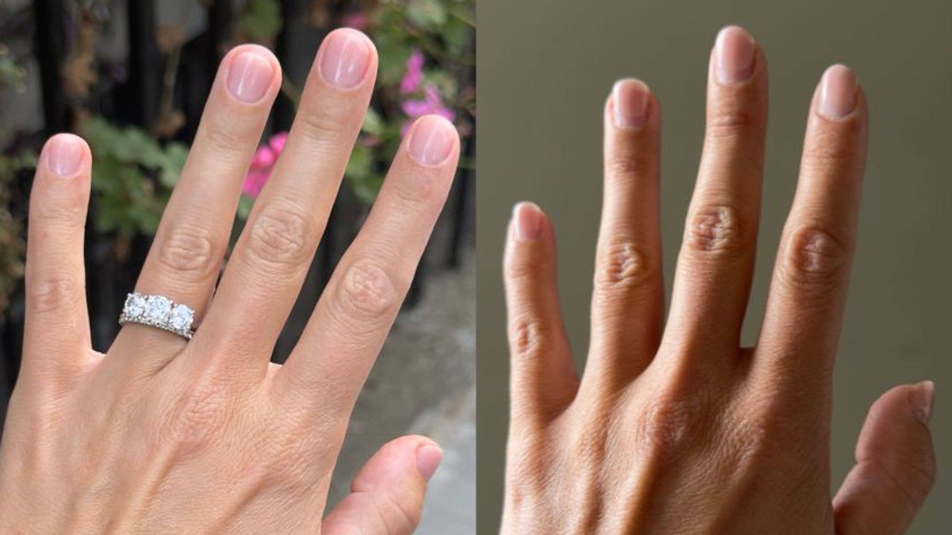 Despite some regrowth, Emma's mani has remained chip-free for five weeks (comparing her nails just after her treatment and five weeks later)